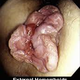 Illustration for article titled obat wasir